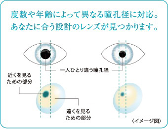 度数や年齢によって異なる瞳孔径に対応。あなたに合う設計のレンズが見つかります。